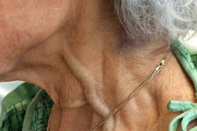 Patient Presents with Shortness of Breath: Neck Examination Findings and Diagnostic Pathways